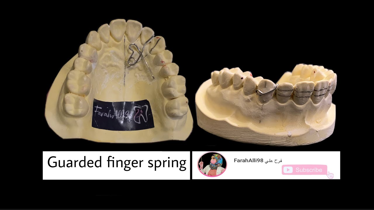 Guarded  Finger Spring