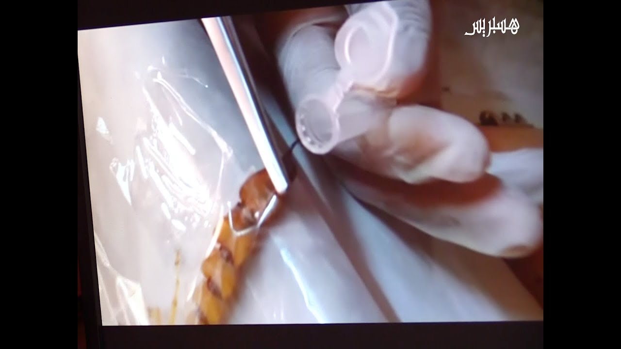 هكذا اخترع مغربي آلة يمكنها استخراج سم العقارب