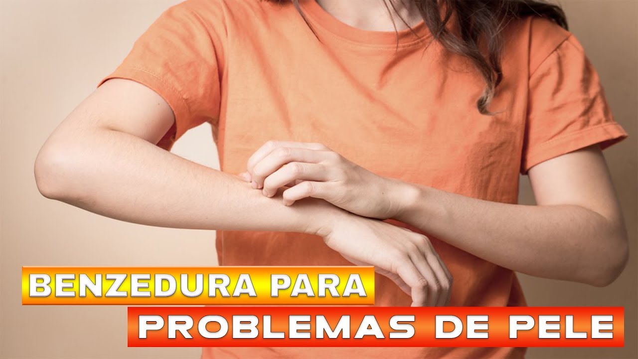 Benzimento para problemas de pele