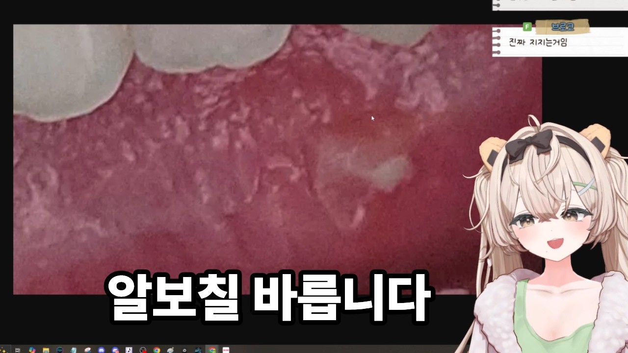 저 알보칠도 잘 발라용