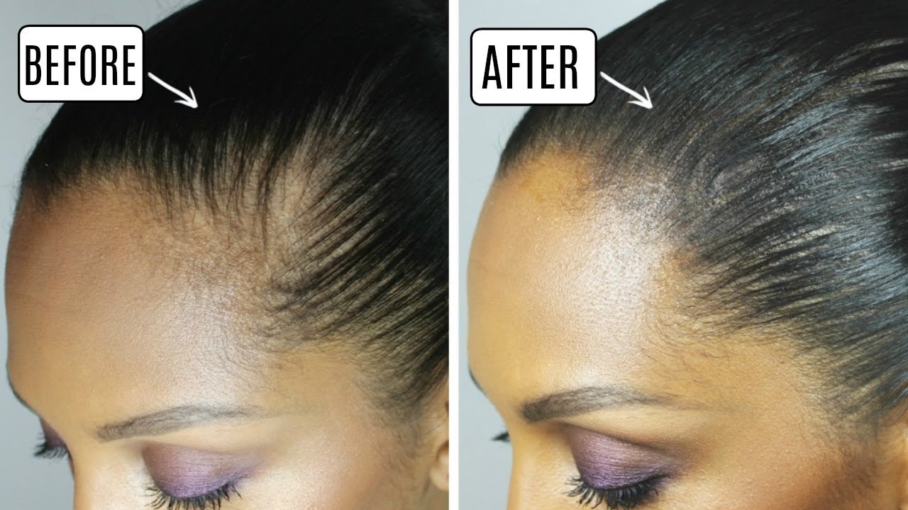 HOW TO: HIDE A BALD SPOT | DISCOCURLSTV