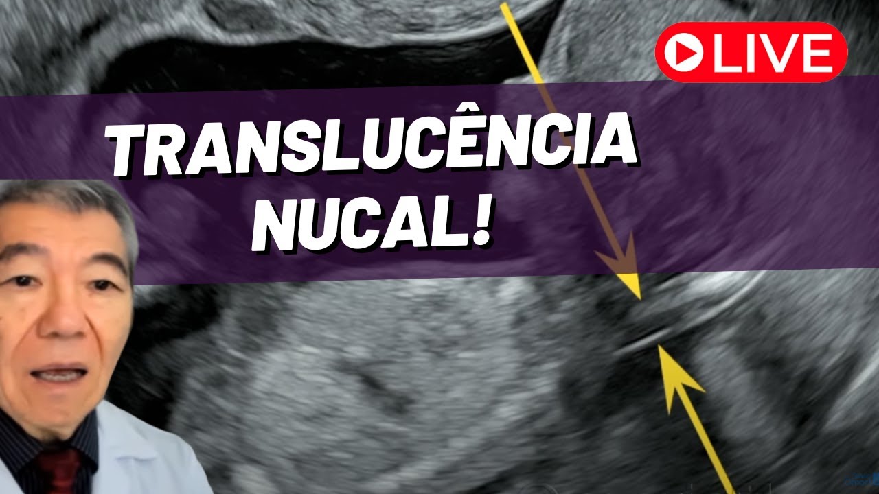 AO VIVO: TRANSLUCÊNCIA NUCAL!!