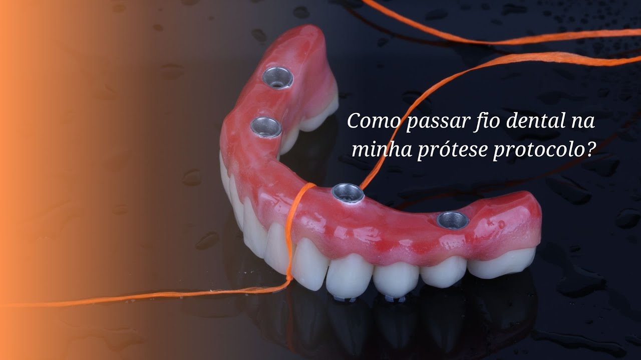 Como passar fio dental na minha prótese protocolo?