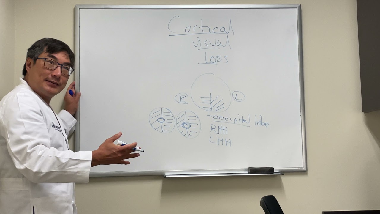 Cortical vision loss