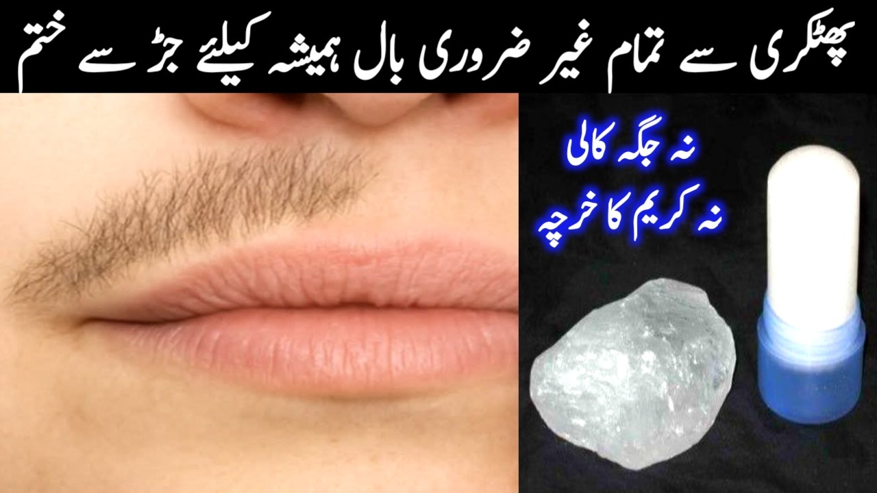 Fitkari for Unwanted Facial Hair removal permenantly | Ghair Zaroori Balon se Nijat Hamesha Ke Liye