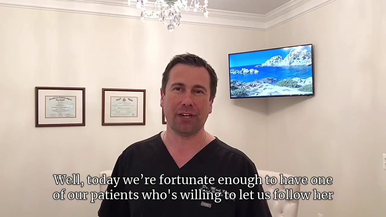🦋 Dr Mark Karolak ‘s Facelift and Neck Lift 🦋