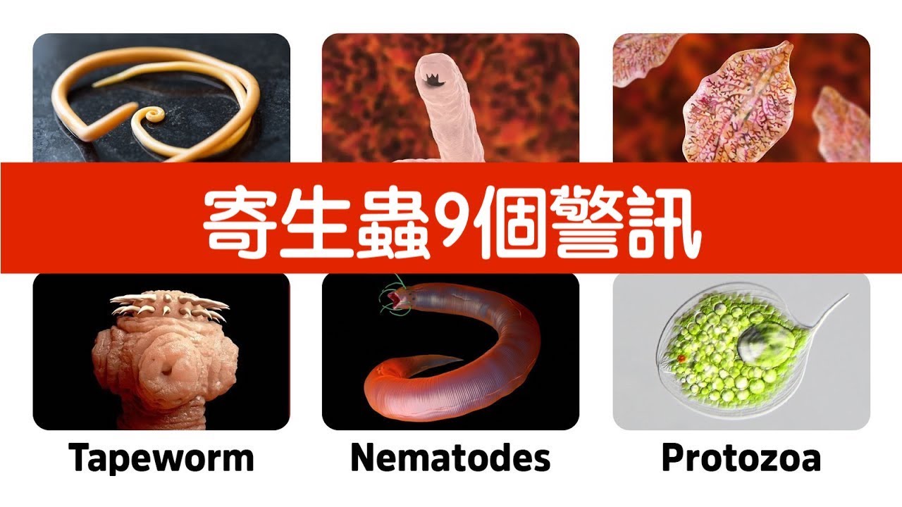 你有寄生蟲9個症狀嗎？自然療法,柏格醫生 Dr Berg
