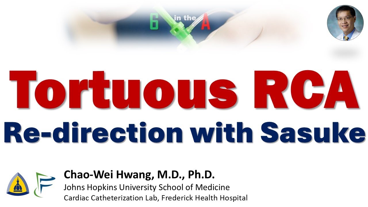 Извилистый RCA: Перенаправление с Саске