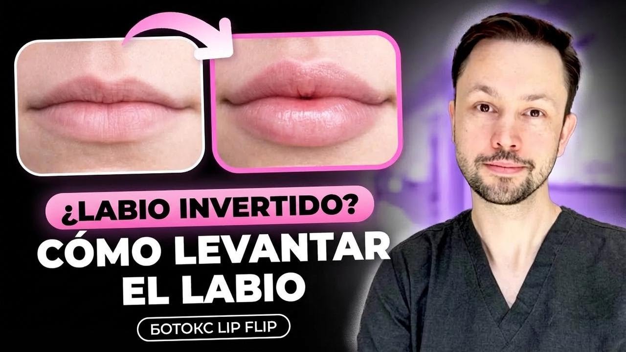 ¿Cómo conseguir labios más grandes? ¿Funciona el Lip Flip con bótox? Alternativas