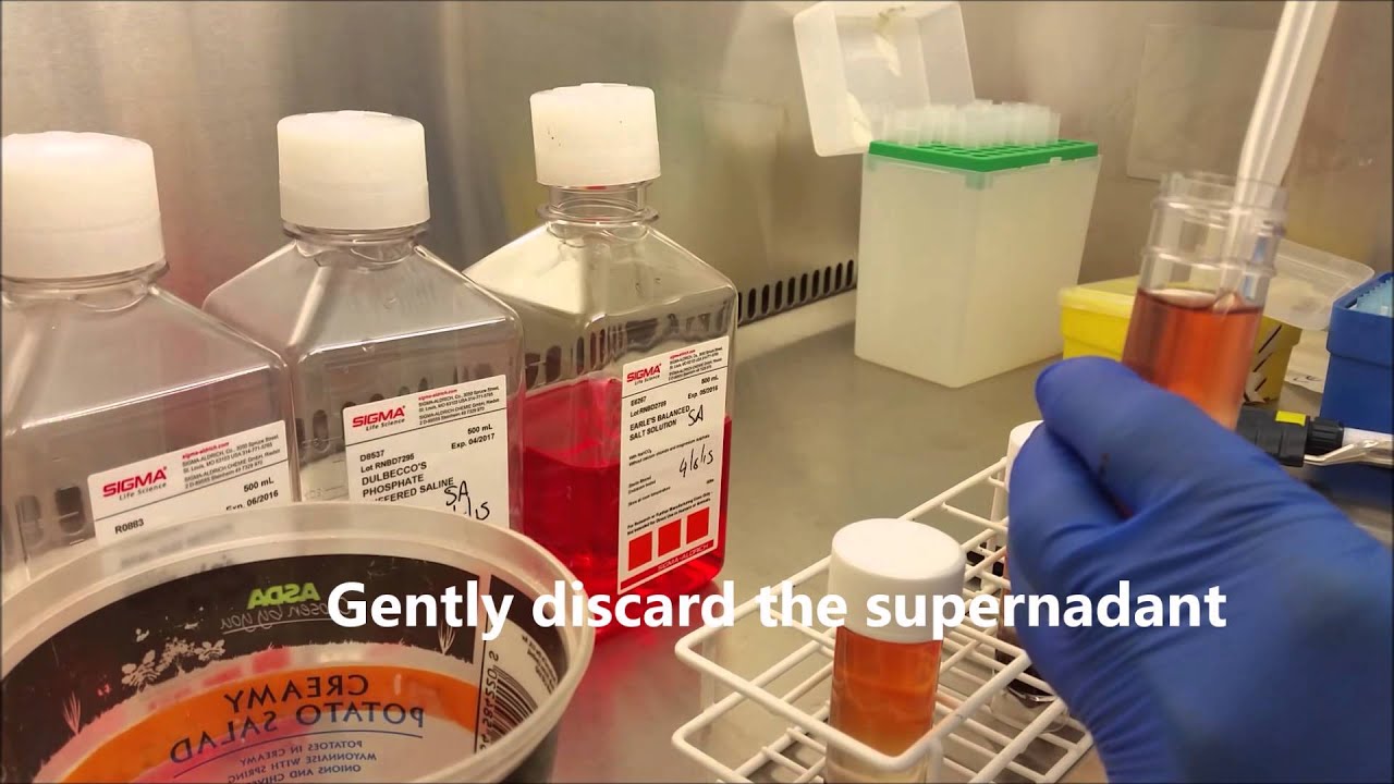 Lymphoprep video 26 08 15