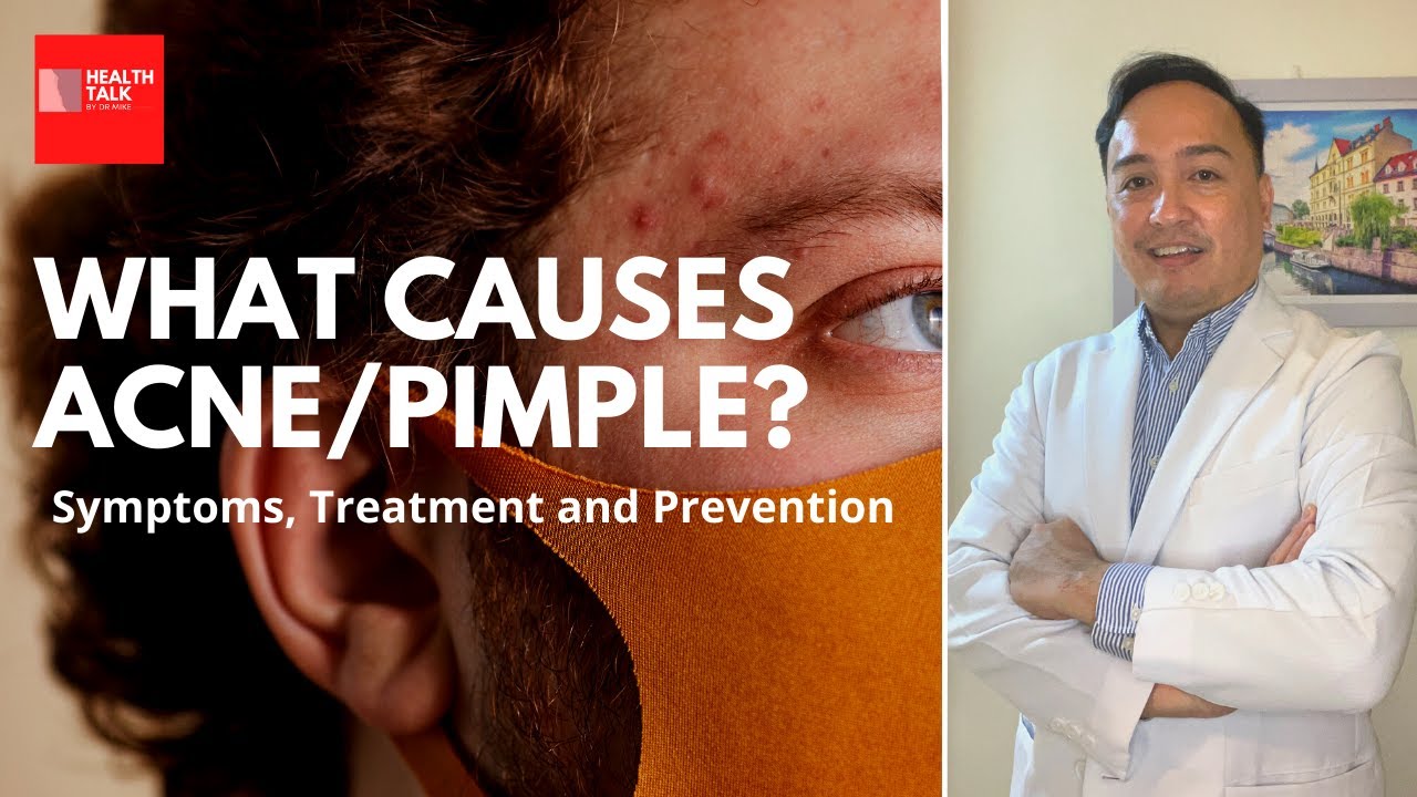 What causes acne or pimple? Symptoms, treatment and prevention