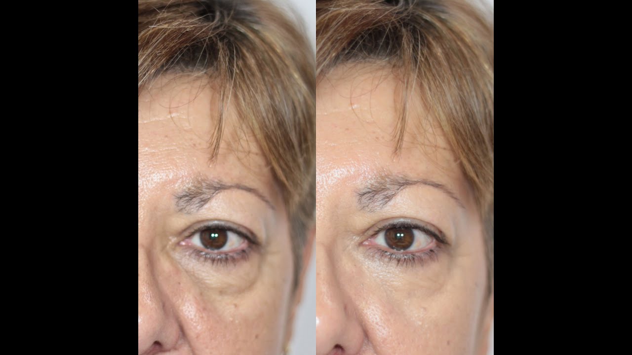 CÓMO QUITAR LAS BOLSAS CON MAQUILLAJE