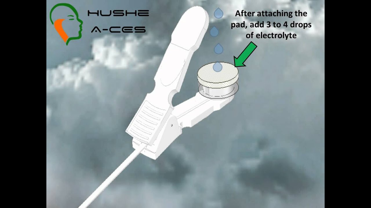 Hushe A-CES Electrodes Guide