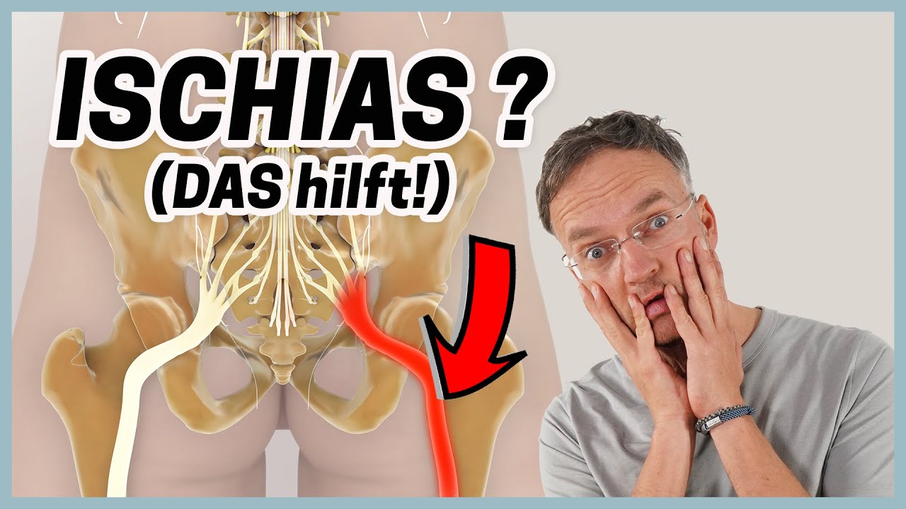 ISCHIAS SCHMERZEN lösen mit diesen 3 Übungen