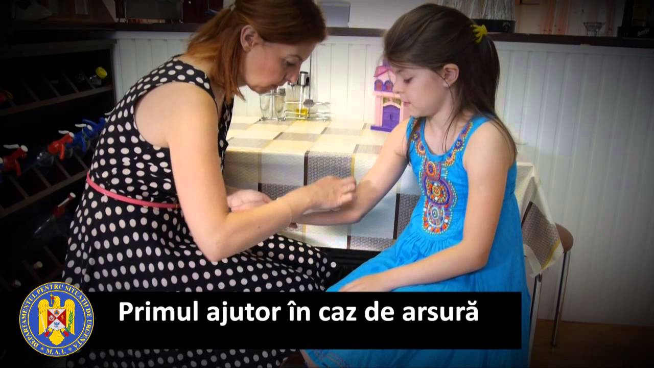 Primul ajutor in caz de arsuri