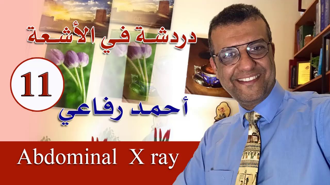 دردشة فى الأشعة - الحلقة 11 - abdominal x ray  - د. أحمد رفاعي