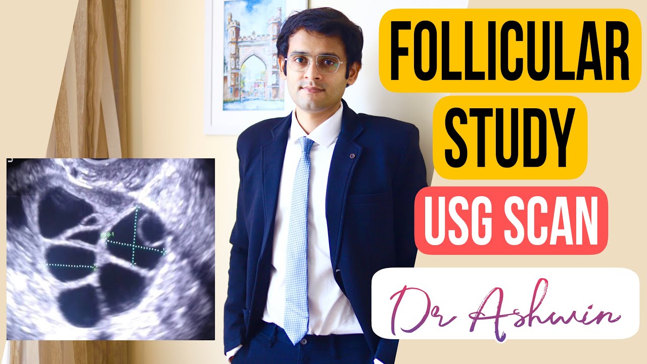 Follicular Study Explained | Ultrasound Scan| Ovulation| Malayalam Video Dr Ashwin Jayakrishnan|