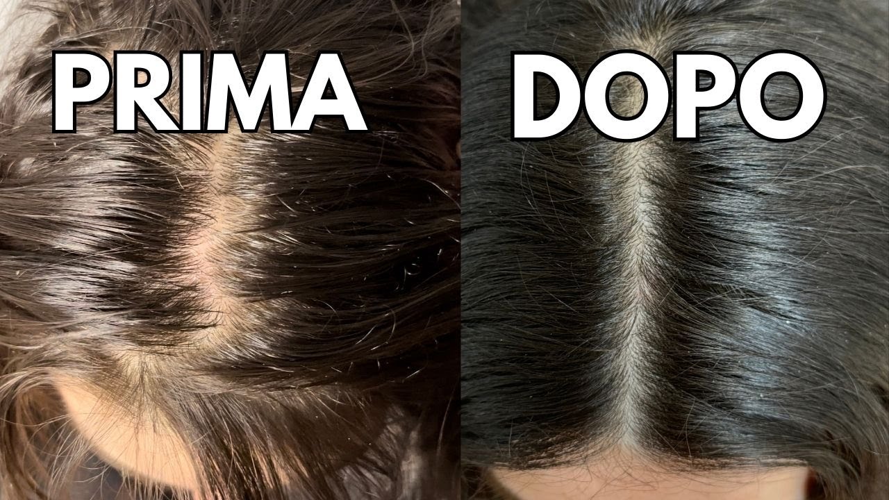 CAPELI UNTI - Come lavare i capelli grassi