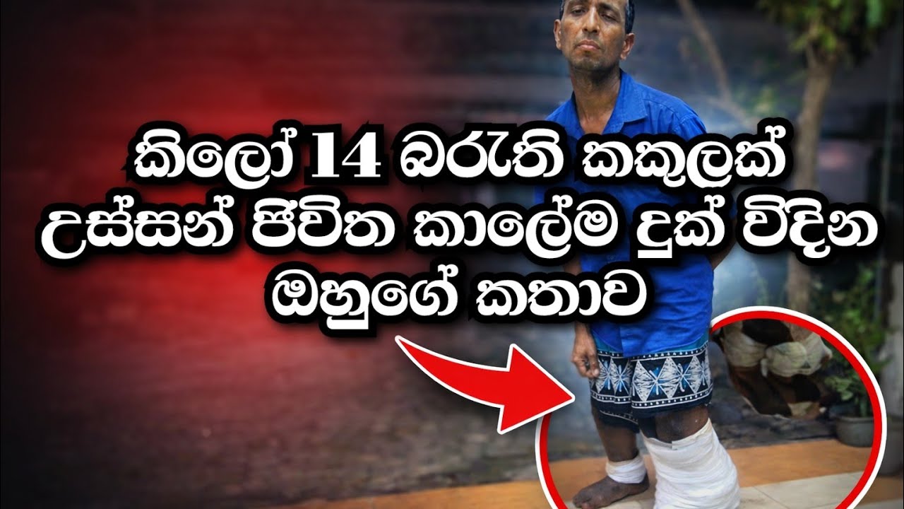 කිලෝ 14 බරැති කකුලක් උස්සන් ජිවිත කාලේම දුක් විදින ඔහු..🥺🥺🥺#sadstory #sadlife#sadstorylife#chamyatra