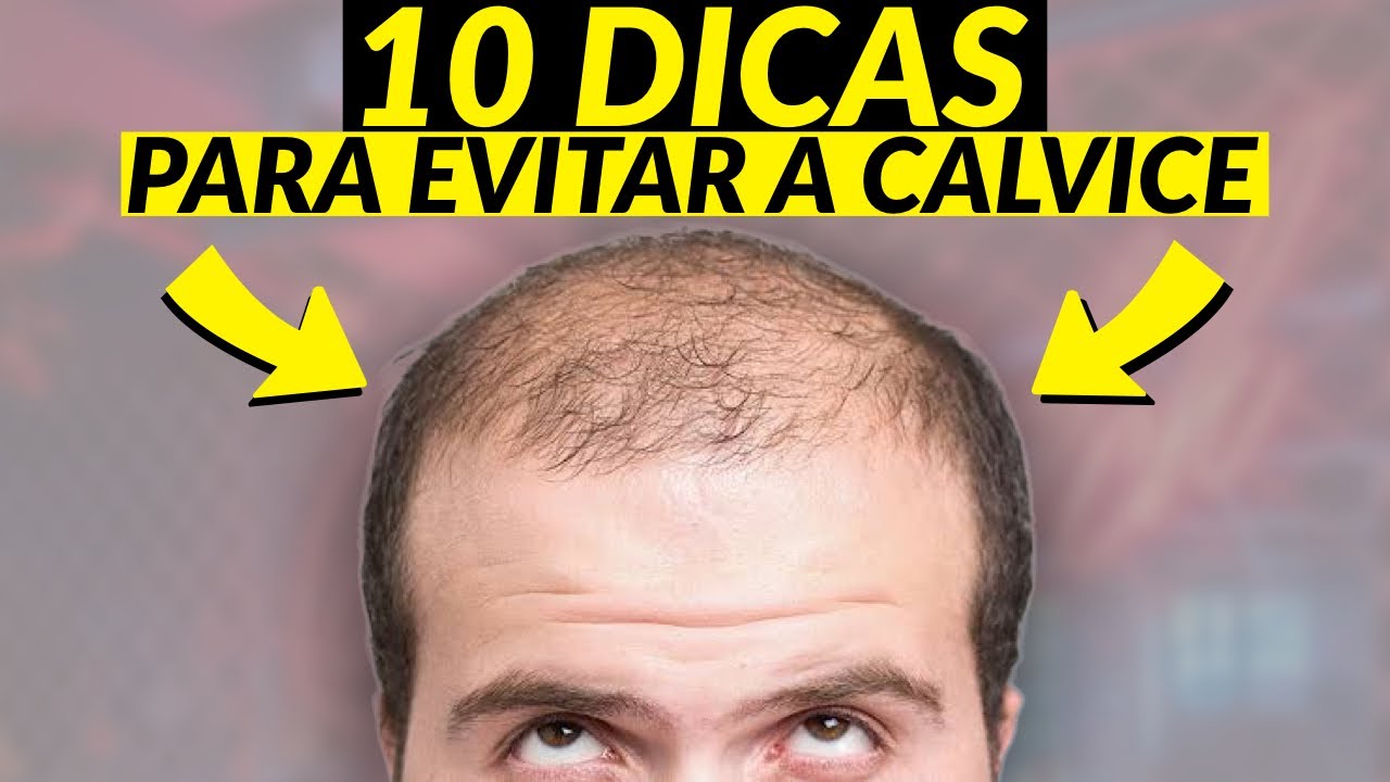 COMO EVITAR A QUEDA DE CABELO EM HOMENS! (ACABAR COM A CALVICE)