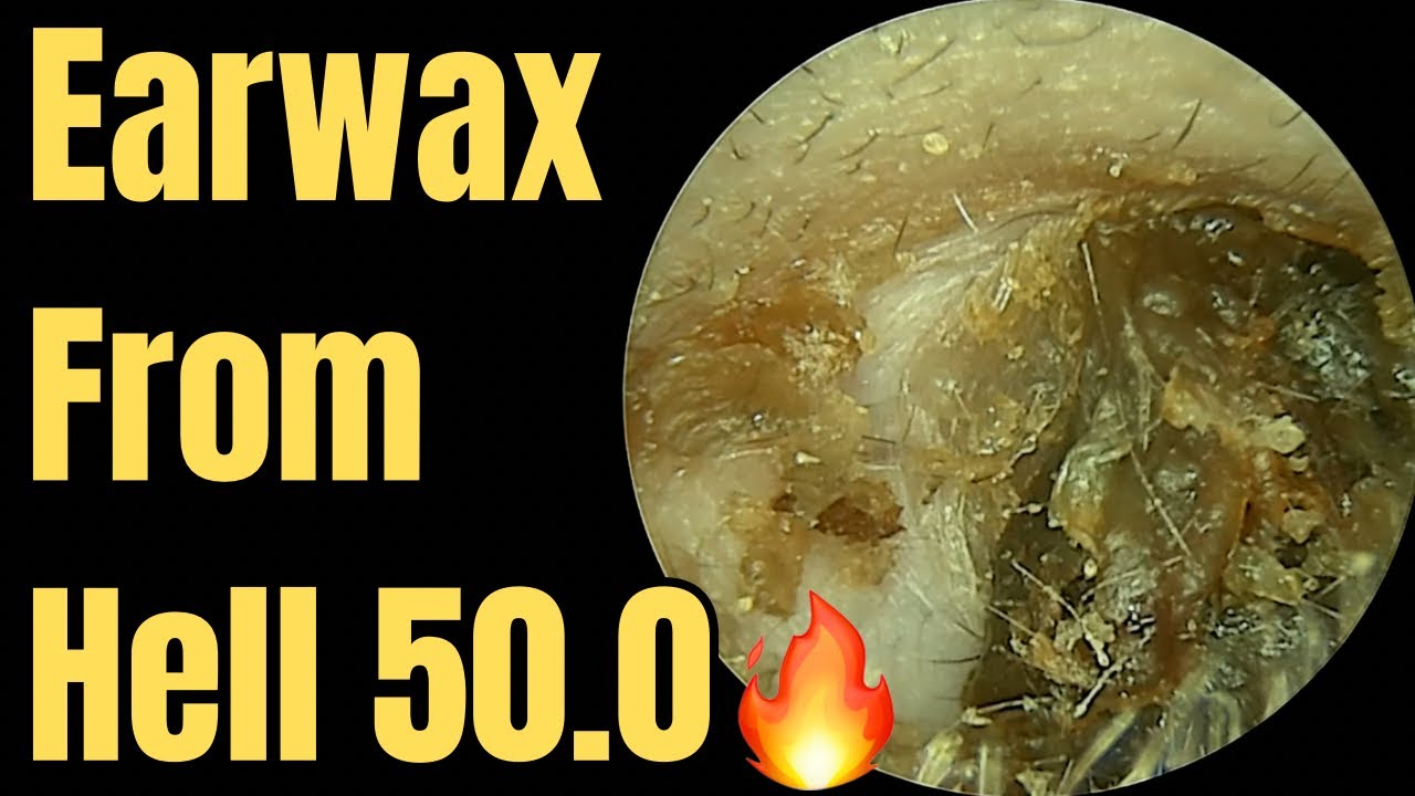 Earwax From Hell 50.0🔥