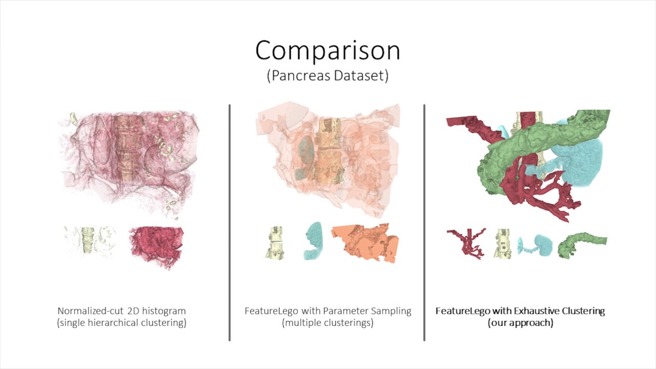 FeatureLego: Volume exploration using exhaustive clustering of super-voxels