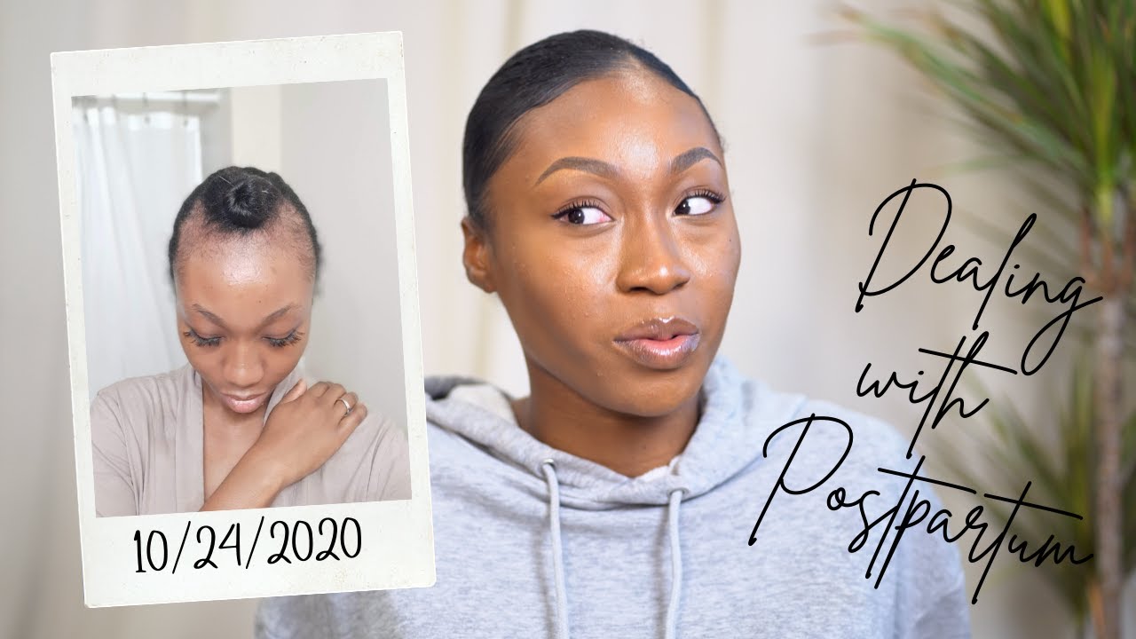 My Postpartum Hairloss Journey | Losing my hair ON MY WEDDING DAY!!!