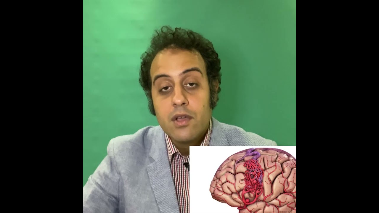 الانواع المختلفة للتشوه الشرياني الوريدي بالمخ | Brain AVM