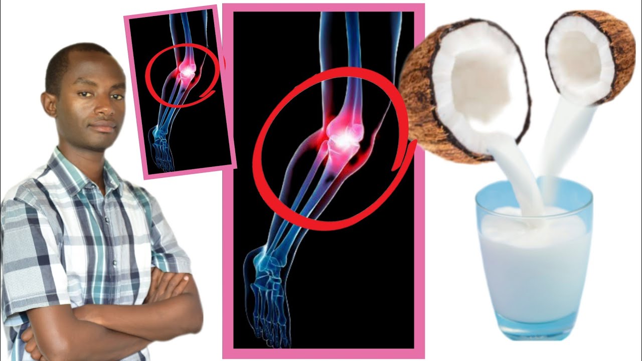 Ubabara amagufa, umugongo, rubagimande, amavi, umutwe. koresha iyi MITI. Akamaro ka coconut ku buzim