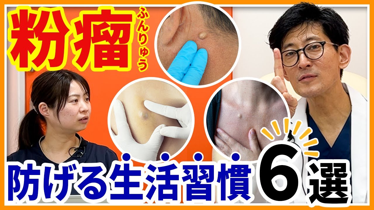 粉瘤は生活習慣で防げる！？ 繰り返さないために“今すぐやめるべき習慣”6選