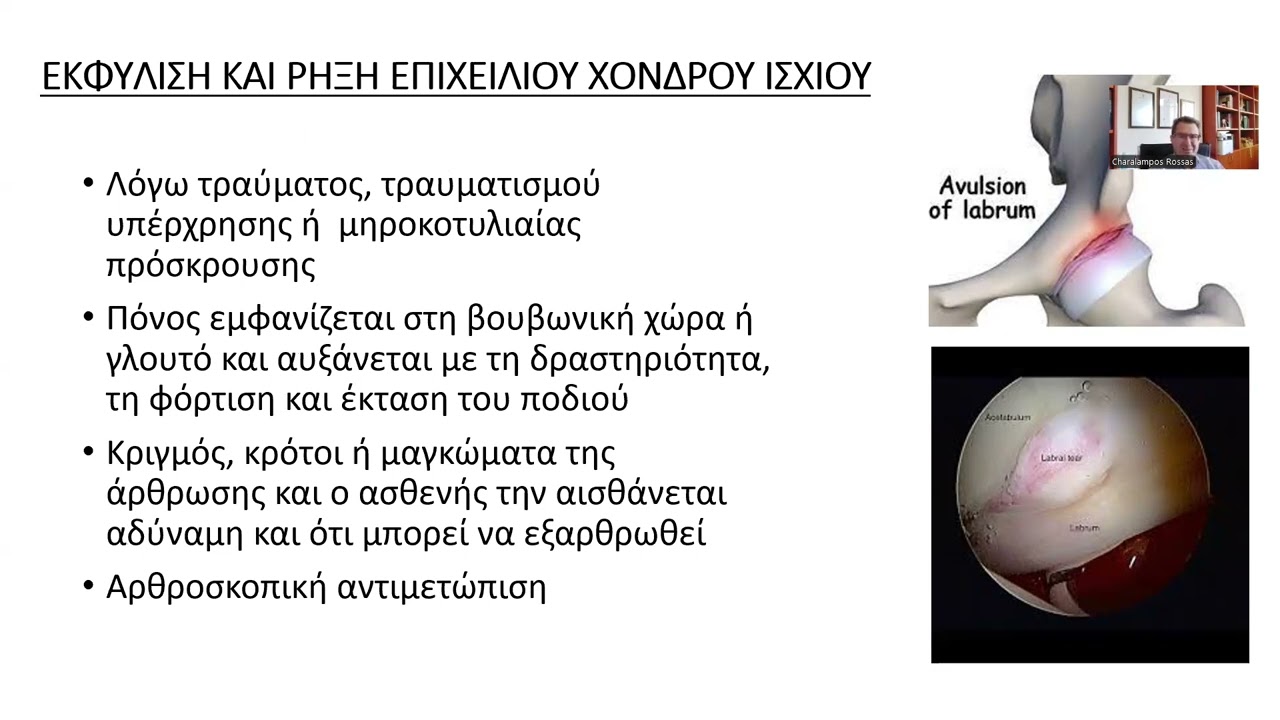 ΡΩΣΣΑΣ