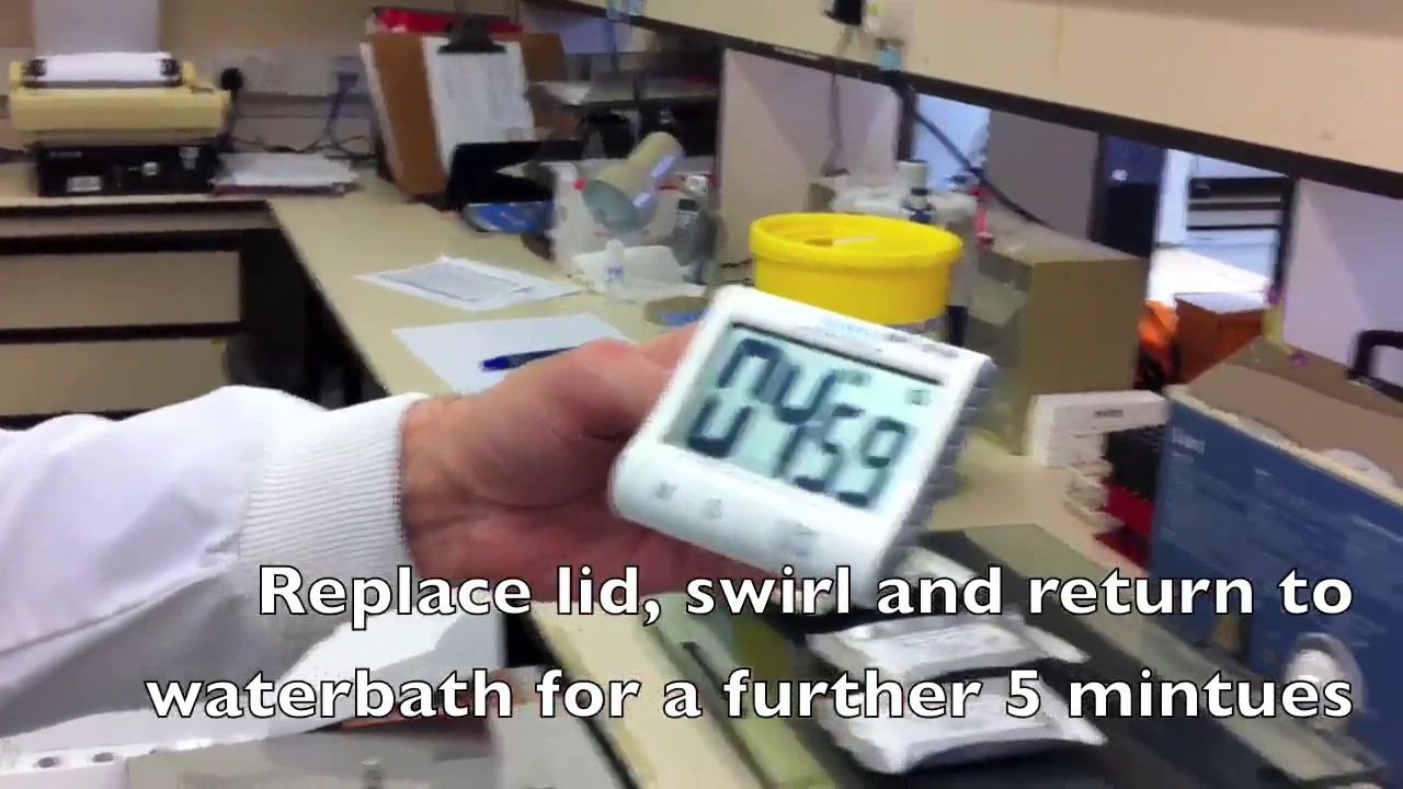 Preparation of Agarose Isoelectric Focusing gel