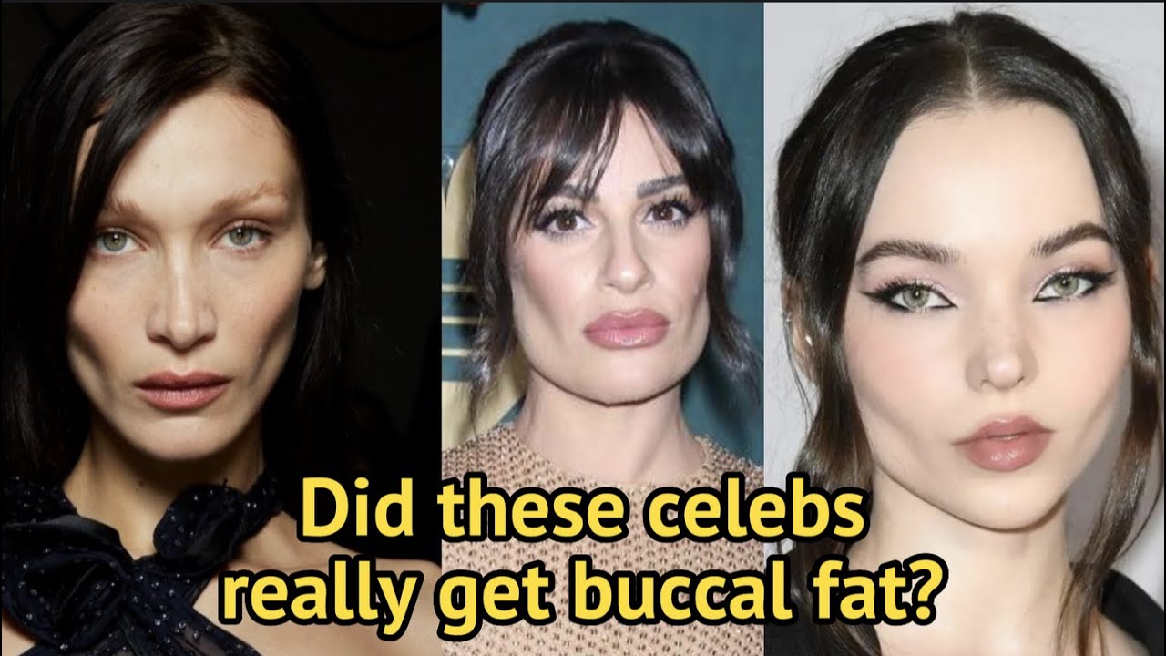 IS THIS WHAT BUCCAL FAT REMOVAL DOES?