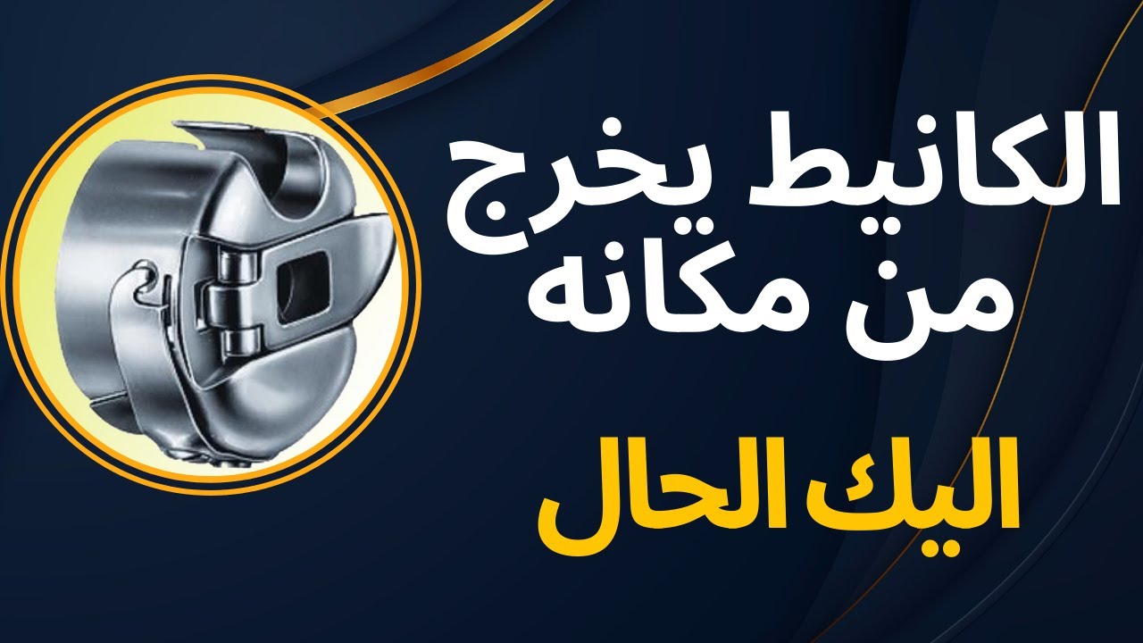 اسباب خروج الكانيط (المكوك) من مكانه اثناء الاشتغال في ماكينة الخياطة