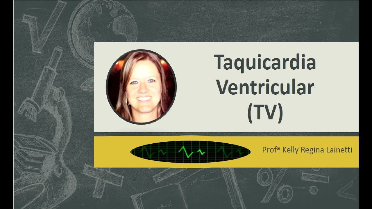 Taquicardia Ventricular (TV)