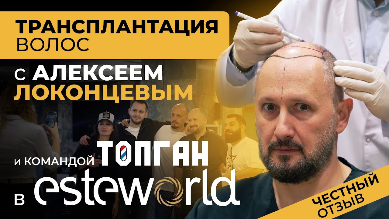 АЛЕКСЕЙ ЛОКОНЦЕВ и команда ТОПГАН на трансплантации волос в клинике ESTEWORLD в ТУРЦИИ