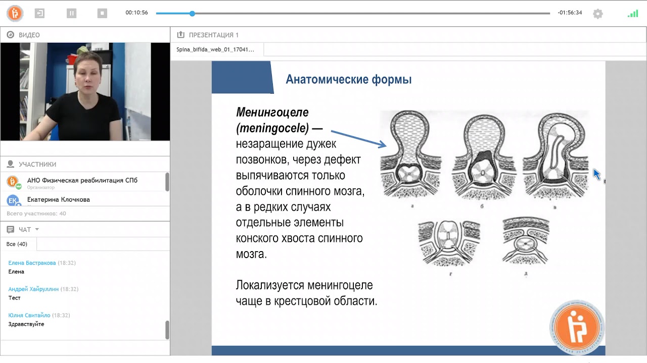 1/10. Spina bifida: введение