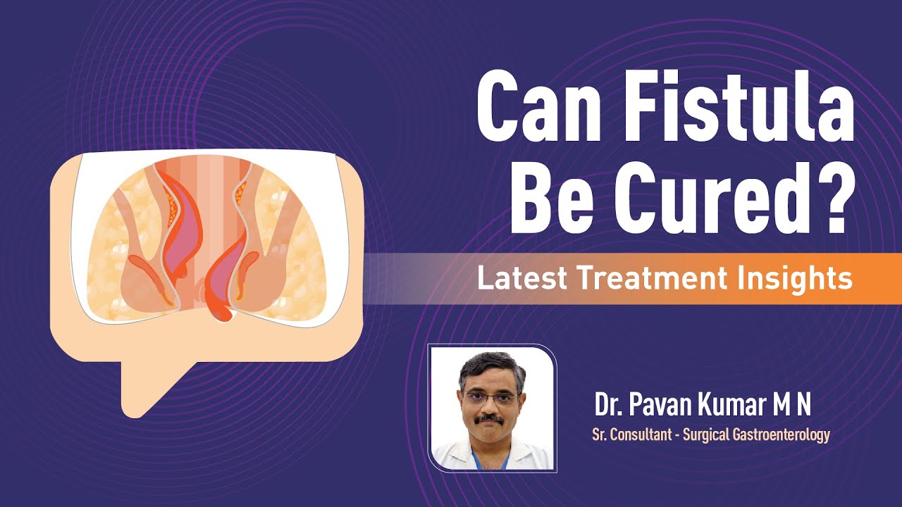 Can Fistula Be Cured? Latest Treatment Insights | Dr. Pavan Kumar M N | Part 2