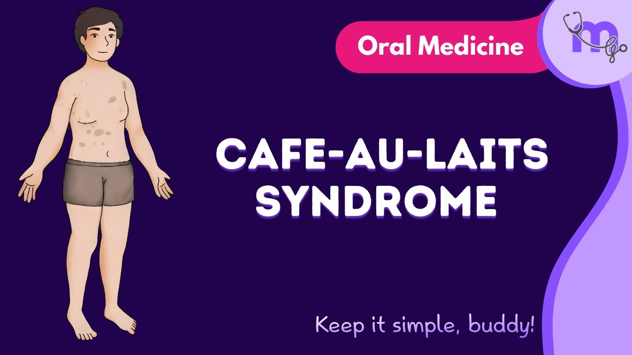 Café au Lait Spots Explained | Types, Borders & Syndromes for Exams