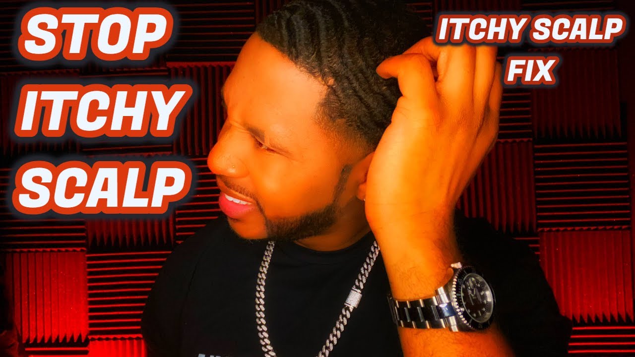 HOW TO STOP ITCHY HAIR, ITCHY SCALP + DANDRUFF