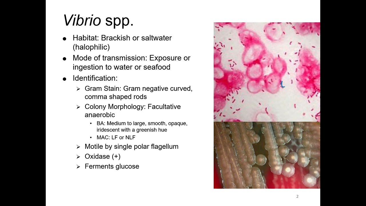 Vibrio, Aeromonas, Campy, & Similar Lecture