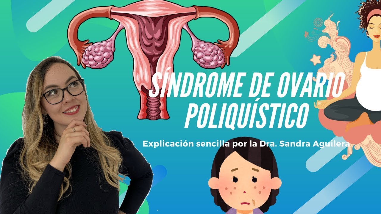 Síndrome de ovario poliquístico: explicación sencilla