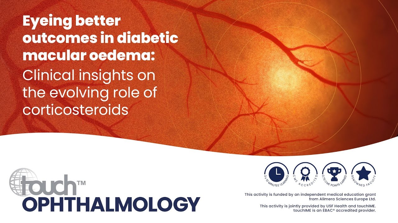 Eyeing better outcomes in diabetic macular oedema: Clinical insights on the role of corticosteroids
