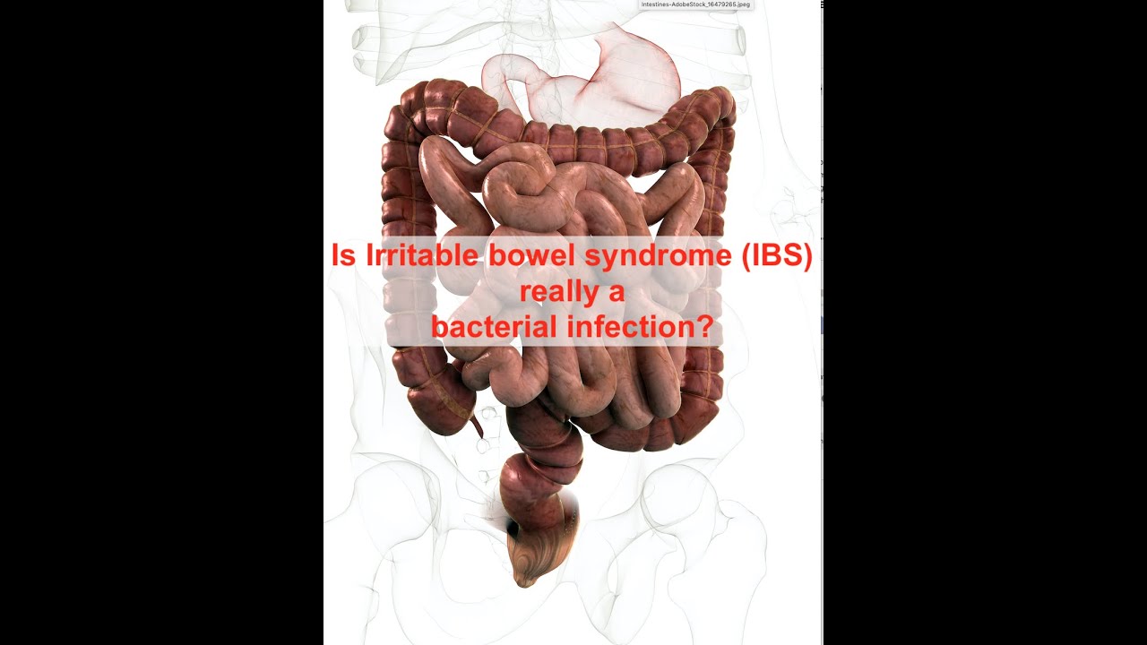 Действительно ли синдром раздраженного кишечника (СРК) является бактериальной инфекцией?
