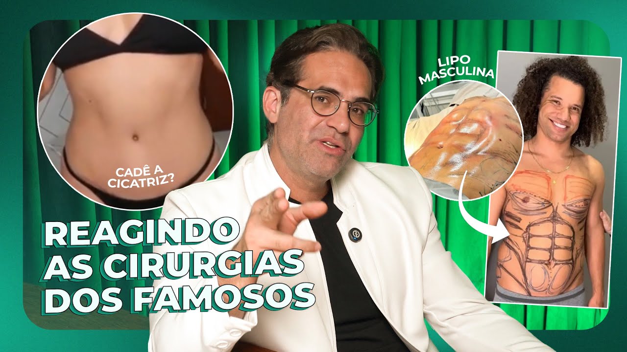 A LIPO HD DO MAYCON (TIO DA MERENDA) DO BBB24