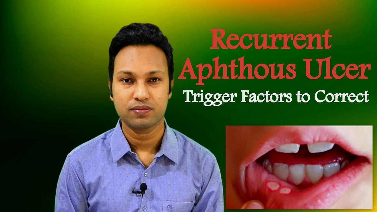 Recurrent Aphthous Ulcer: Trigger Factors to Correct