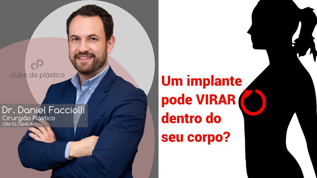 Clube da Plástica: Um implante pode virar dentro do seu corpo?