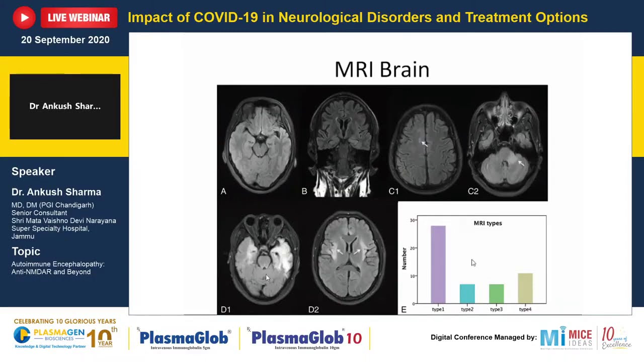 Part 4 - Autoimmune Encephalopathy: Anti-NMDAR and Beyond - Dr. Ankush Sharma