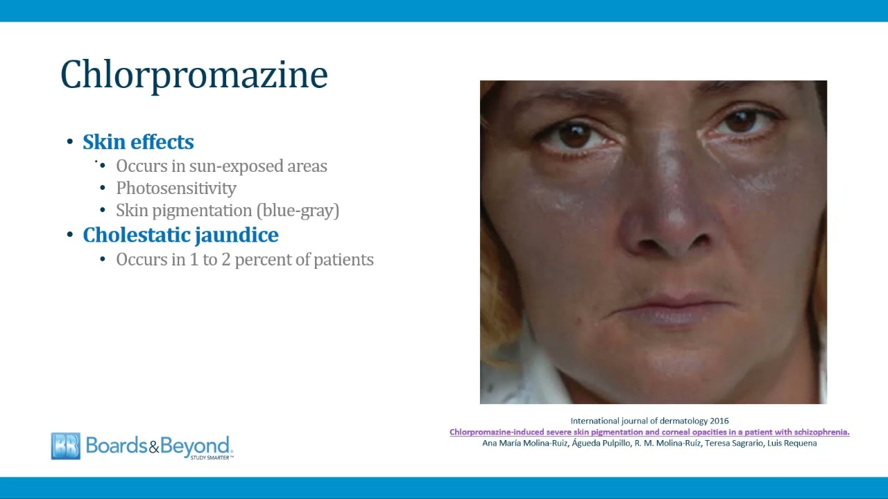 Psychiatry USMLE Step 2-3 &mdash; Antipsychotics &mdash; Boards and Beyond