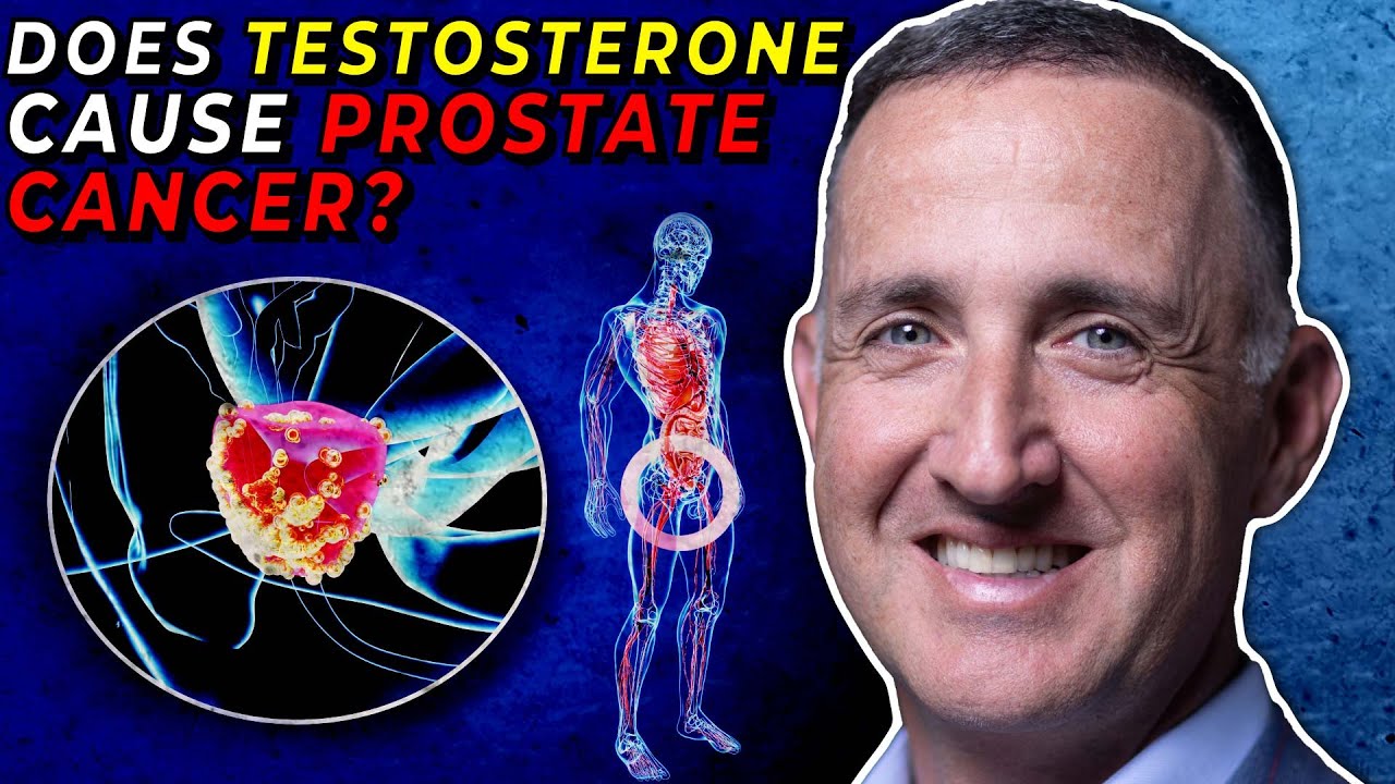 Does Testosterone Cause Prostate Cancer?